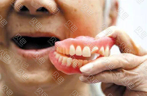 看完维他灵活动义齿图片和优缺点我感觉自己并不适合