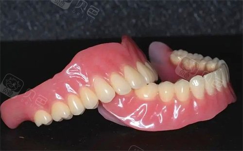 老人牙齿掉光了装全口固定假牙好还是活动假牙好