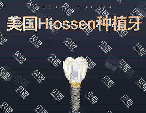 美国皓圣种植牙