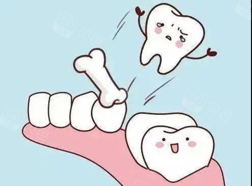 固定松动牙大概要多少钱得看你牙齿松动原因和松动程度