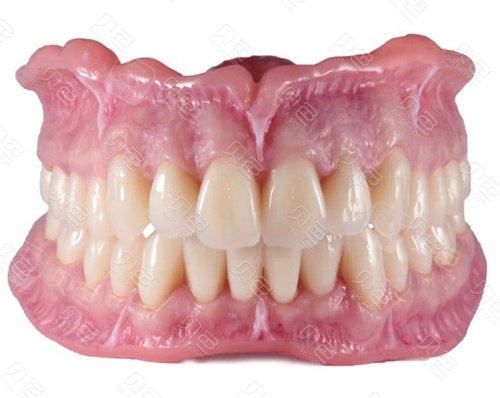 这种吸附性义齿从理论上说也是活动假牙的一种,但是在使用方面牢固