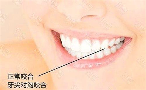 对照整齐的牙齿标准图看看你的牙齿排列是否正常？(图2)
