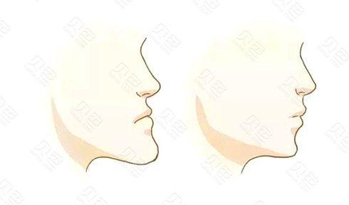 对照整齐的牙齿标准图看看你的牙齿排列是否正常？(图7)
