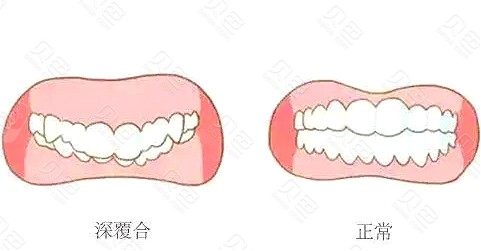 对照整齐的牙齿标准图看看你的牙齿排列是否正常？(图10)