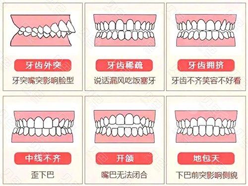 对照整齐的牙齿标准图看看你的牙齿排列是否正常？(图9)