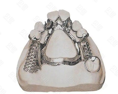 正经科普:纯钛全口假牙优缺点,看完再按也不迟 - 贝色口腔