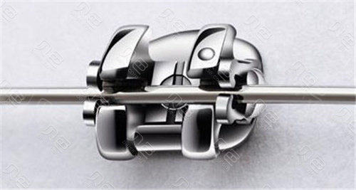 美国3m金属自锁托槽矫正器