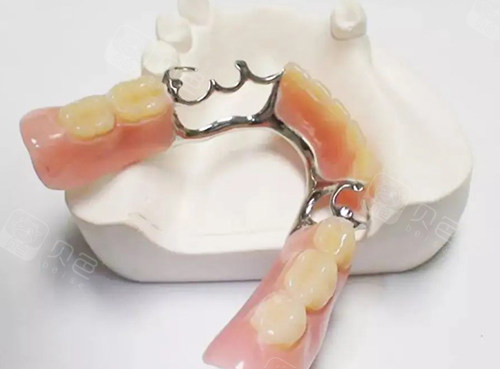 3800元起普通不锈钢全口活动义齿:2500元起活动性隐形义齿:800元起