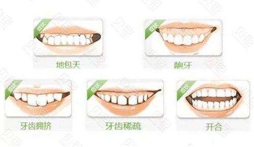 大庆牙科诊所牙齿矫正示意图