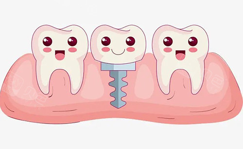 这份铁岭种植牙价格表值得收藏