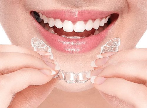 隐形牙齿牙套图