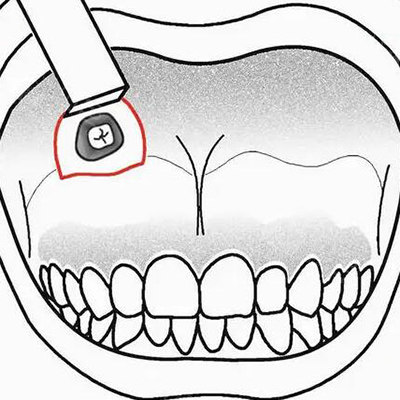 智齿展示图卡通