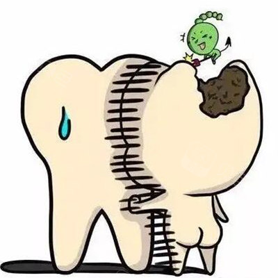 牙齿龋坏展示图照片