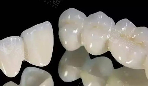 全瓷牙