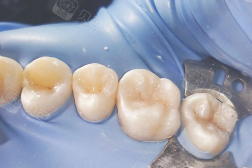 三门峡补牙哪家好?市区牙友推荐出这几家靠谱又实惠!