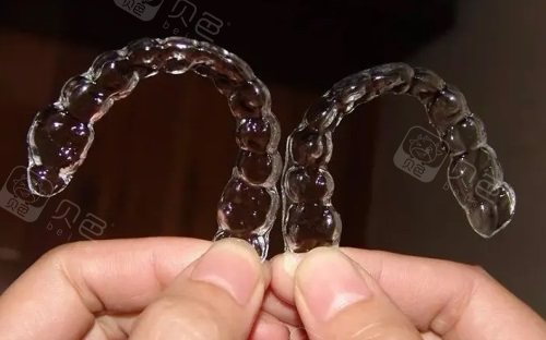隐形牙套示意图