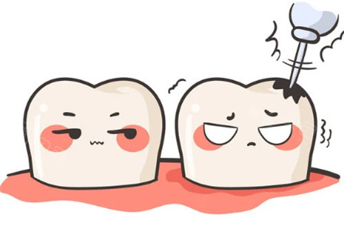 补牙卡通图