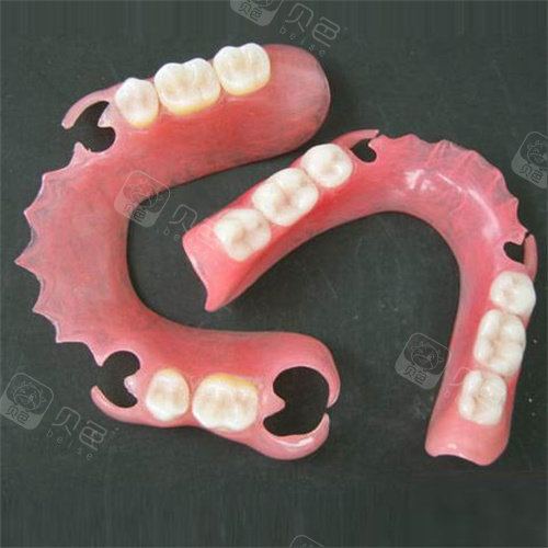 隐形义齿模型图