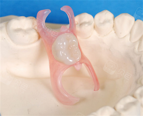 隐形义齿是什么材质做的?它的优缺点又有哪些呢? - 贝色口腔