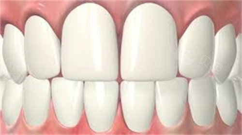 整齐牙齿标准图在x光片下是怎样?不正当咬合会引发什么 - 贝色口腔