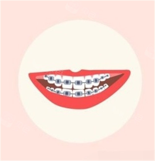 forestadent怎么读更新2023十大自锁托槽品牌排行榜!国产／进口品牌都包含!_https://www.jmylbn.com_新闻资讯_第8张