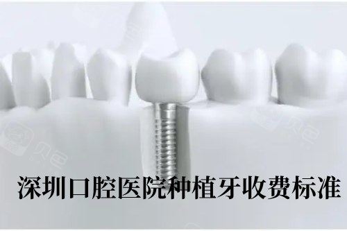 深圳口腔医院种植牙收费标准