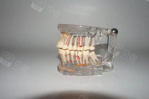 排龈线的作用真不小，附具体放置多长时间/多久取出合适！ - 沃牙网