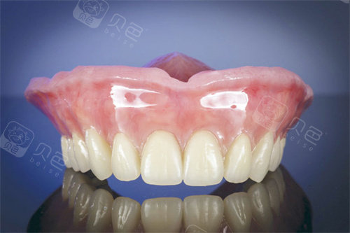 国产dsa有哪些品牌没看错!吸附性义齿有三种档次,品牌决定价格：DSA｜GS｜莱美｜BPS｜从1万到3万差异也不小_https://www.jmylbn.com_新闻资讯_第3张