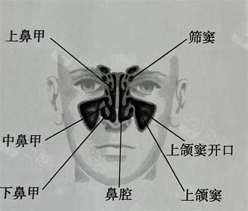 认识与了解！详细介绍上颌窦穿孔的症状表现，对号入座看你是不是上颌窦穿孔！ - 沃牙网