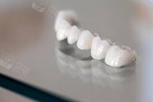 深圳德贝美口腔牙冠宣传图