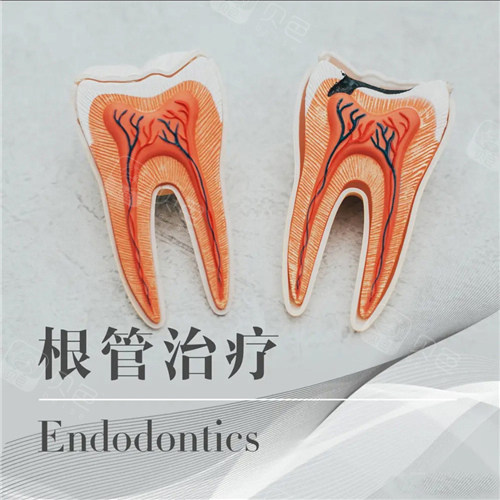 根管马达怎么修黑科技解析！根管马达和机扩是一样的吗？定义｜工作原理｜应用差异及优势等存在差异！_https://www.jmylbn.com_新闻资讯_第3张