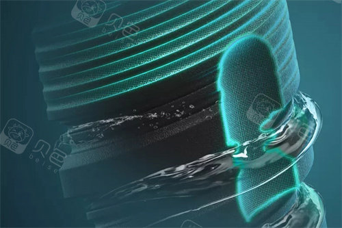 卡瓦口腔怎么购买德国卡瓦ABT种植体怎么样？一般多少钱？材质稳定／型号多样／独特设计／单颗植体9k+_https://www.jmylbn.com_新闻资讯_第2张