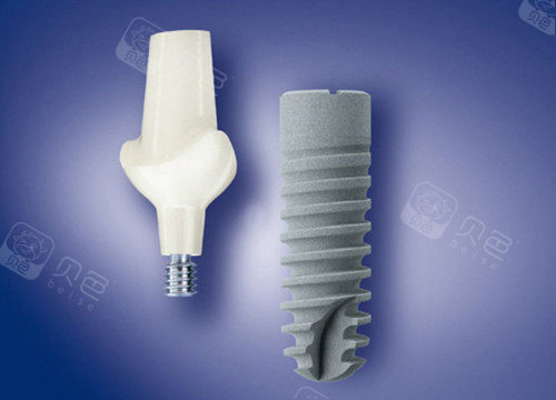 愈合机台怎么识别型号超详细！愈合基台穿龈高度怎么看？愈合基台穿龈高度自测秘籍，一看就懂！_https://www.jmylbn.com_新闻资讯_第1张