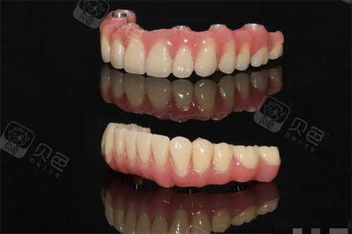 全口马龙桥示意图