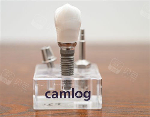 卡瓦口腔怎么购买深度评测！德国卡瓦种植牙怎么样？值不值得种？材料／技术／结果／价格／口碑深入探讨很可靠！_https://www.jmylbn.com_新闻资讯_第1张