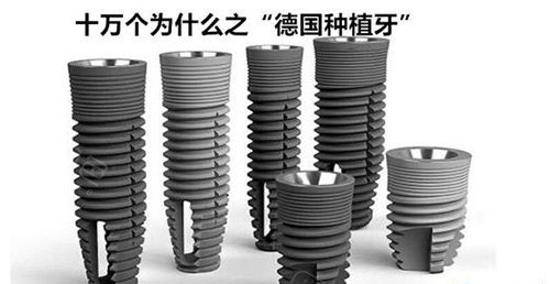 卡瓦口腔怎么购买深度评测！德国卡瓦种植牙怎么样？值不值得种？材料／技术／结果／价格／口碑深入探讨很可靠！_https://www.jmylbn.com_新闻资讯_第3张