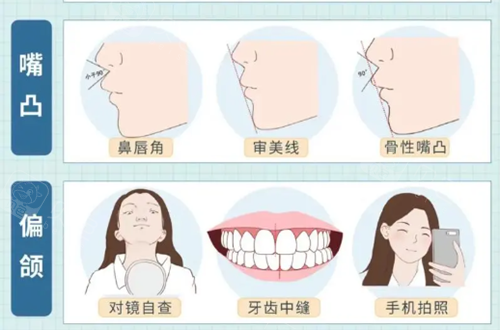 一文解析偏颌怎么判断是牙性还是骨性，快看偏颌导致脸歪怎么正确矫正好呢 - 沃牙网