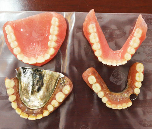 口腔材料怎么销售那些问怎么在家自己做假牙？自己制作假牙需要买哪些材料？的，你确定自己做的假牙真的能用？_https://www.jmylbn.com_新闻资讯_第2张