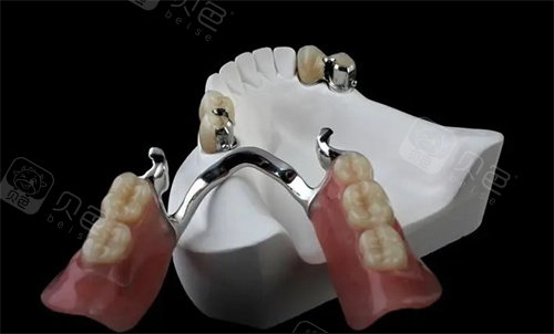 口腔材料怎么销售那些问怎么在家自己做假牙？自己制作假牙需要买哪些材料？的，你确定自己做的假牙真的能用？_https://www.jmylbn.com_新闻资讯_第3张