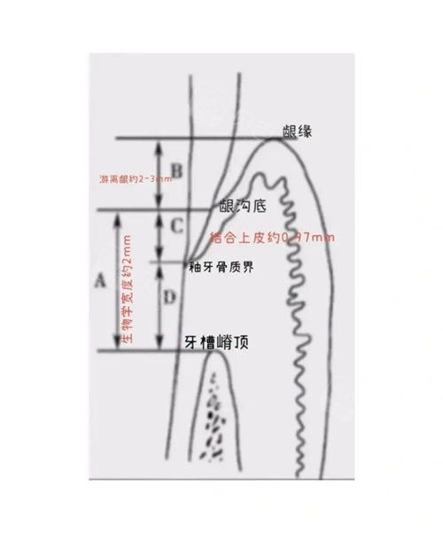 牙龈和牙龈沟是指哪里?详细位置图解来咯!顺便说说龈嵴顶和龈沟的区别是什么 - 沃牙网