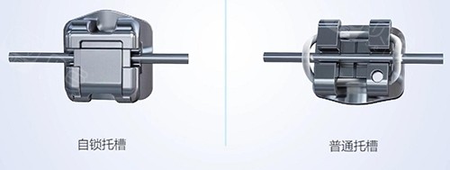 forestadent怎么读全解析！被动自锁托槽有哪些品牌？奥美科／3M／奥美AO／非凡／普特／欧晴新亚等国内外品牌揭晓！_https://www.jmylbn.com_新闻资讯_第1张