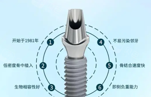 安卓健种植体