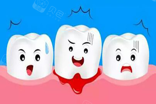 口腔激光怎么治疗激光牙周治疗全口要多少钱？根据严重程度不同,费用在1400元到5800元之间波动!_https://www.jmylbn.com_新闻资讯_第3张