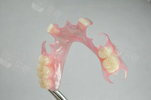 牙科材料硅胶怎么用义齿软衬材料使用方法解析：从术前认识材料｜选择适合材料｜操作步骤｜术后维护全流程揭晓！_https://www.jmylbn.com_新闻资讯_第3张