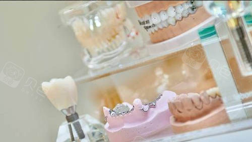 拍片机怎么拆卸没有拍片机器的口腔诊所真的靠谱吗？全方面分析：医疗服务正规性不全都依赖硬件_https://www.jmylbn.com_新闻资讯_第5张