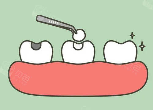 口腔光固化灯是什么光光固化复合树脂和3m树脂的区别主要表现在美观性／生物相容性／价格／耐磨性方面_https://www.jmylbn.com_新闻资讯_第1张