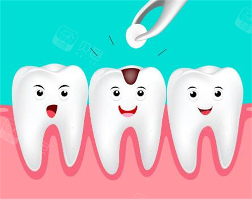 口腔光固化灯是什么光光固化树脂补牙牢固吗？牢固性较高！详细分析光固化树脂补牙的优点~快来了解_https://www.jmylbn.com_新闻资讯_第2张