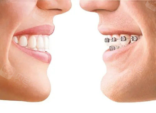 卡瓦口腔怎么购买更新了，常州卡瓦2025全新口腔价格表，种植牙约3000元起｜牙齿矫正约5000元起｜拔牙补牙等价格一览~_https://www.jmylbn.com_新闻资讯_第2张