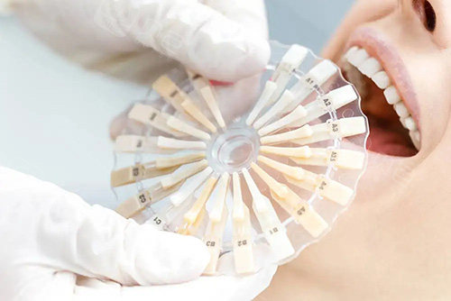 卡瓦口腔怎么购买更新了，常州卡瓦2025全新口腔价格表，种植牙约3000元起｜牙齿矫正约5000元起｜拔牙补牙等价格一览~_https://www.jmylbn.com_新闻资讯_第4张