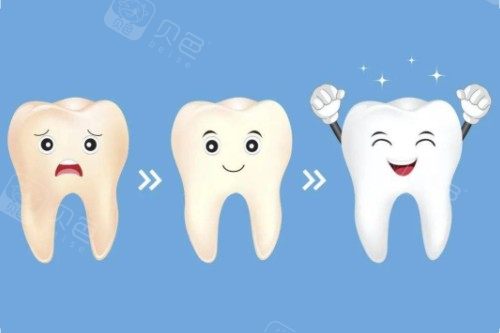 牙齿美白顺序图